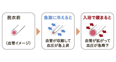 急激に冷えると血管が収縮して血圧が急上昇　入浴で暖まると血管が拡がって血圧が急降下